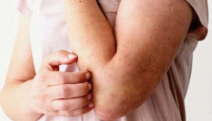 Understanding Inflammation: The Body’s Defense Mechanism and Its Complexities